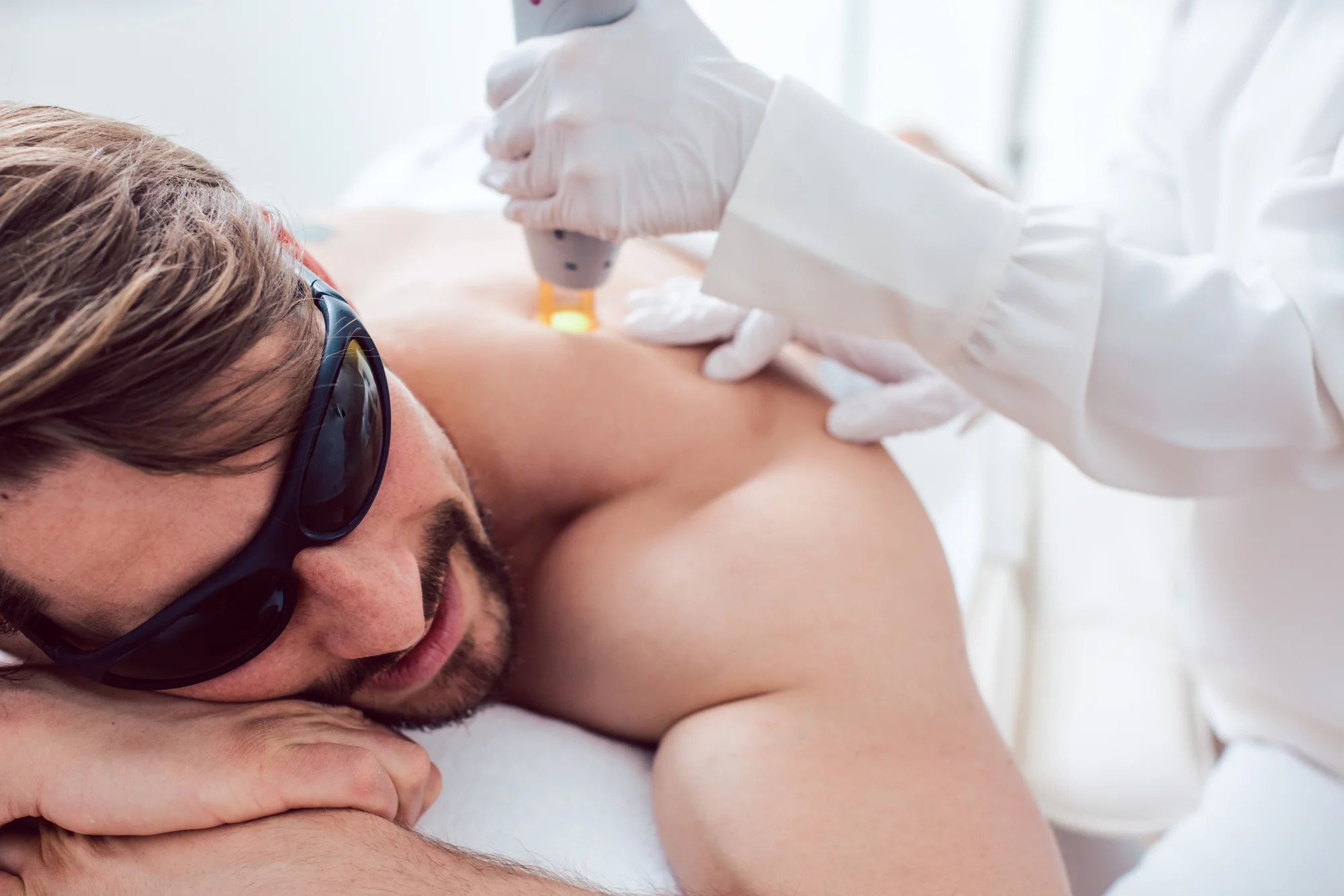 Trvalá epilácia medicínskym laserom Candela GentleLase PRO – Obrázok 2