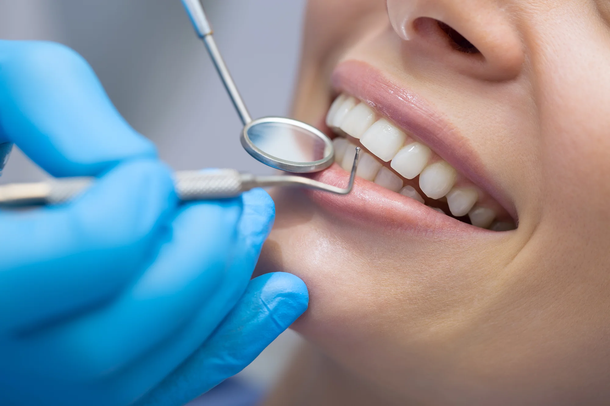Komplexné vyšetrenie chrupu a dentálna hygiena v PUREDENT Košice – Obrázok 2