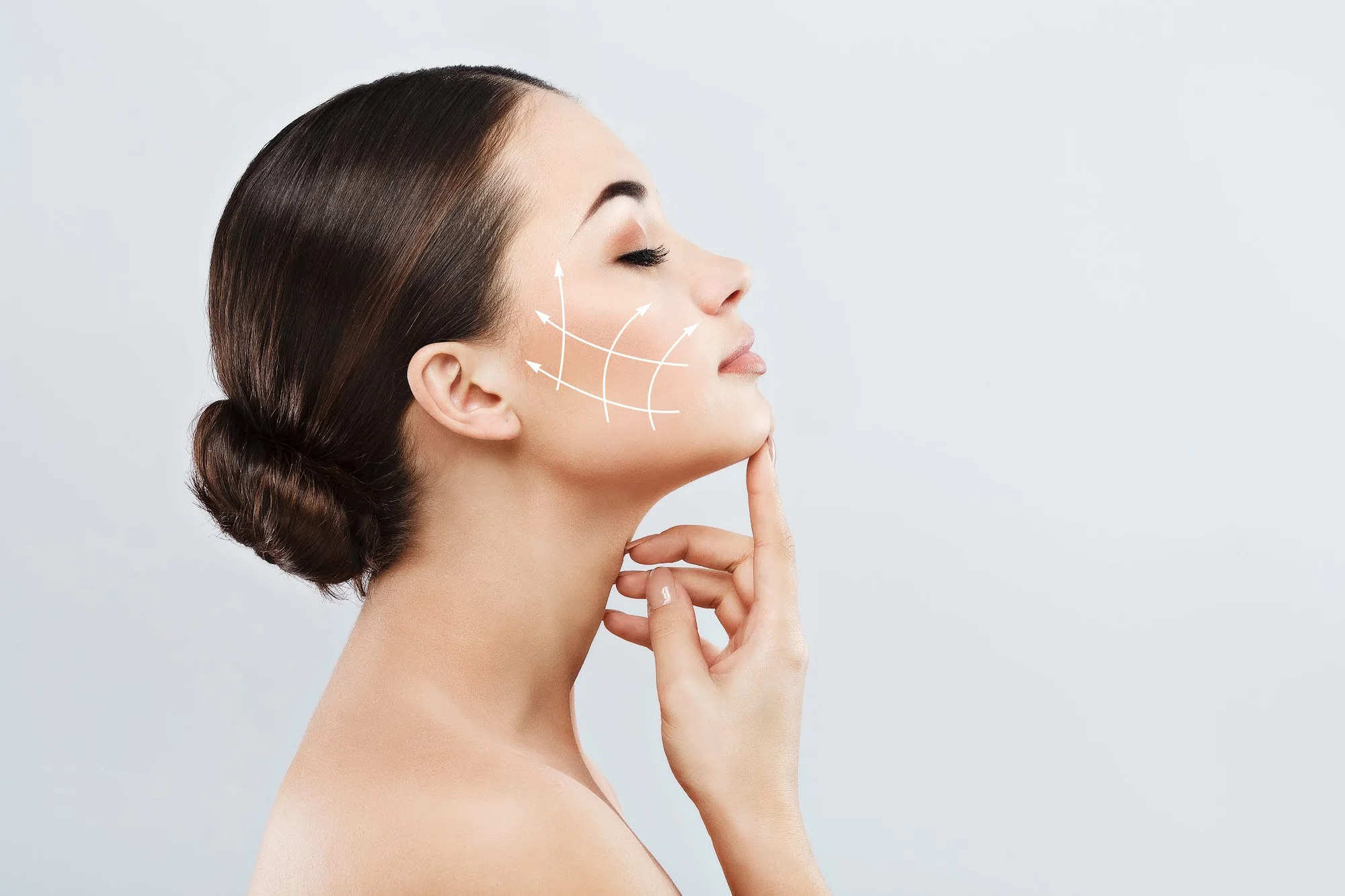 Horný, dolný a celkový facelifting HIFU – Obrázok 2