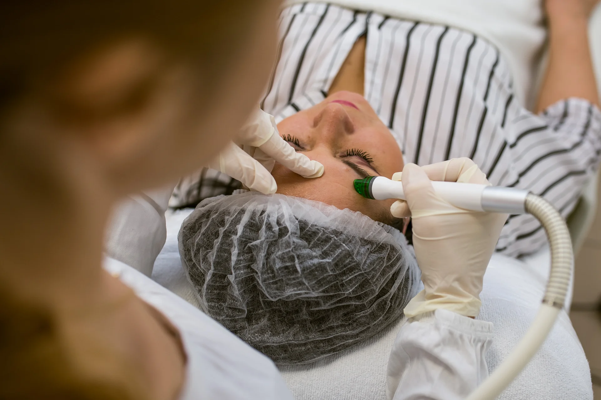 Kozmetické ošetrenia pre všetky typy pleti špičkovým prístrojom ProFacial – Obrázok 3