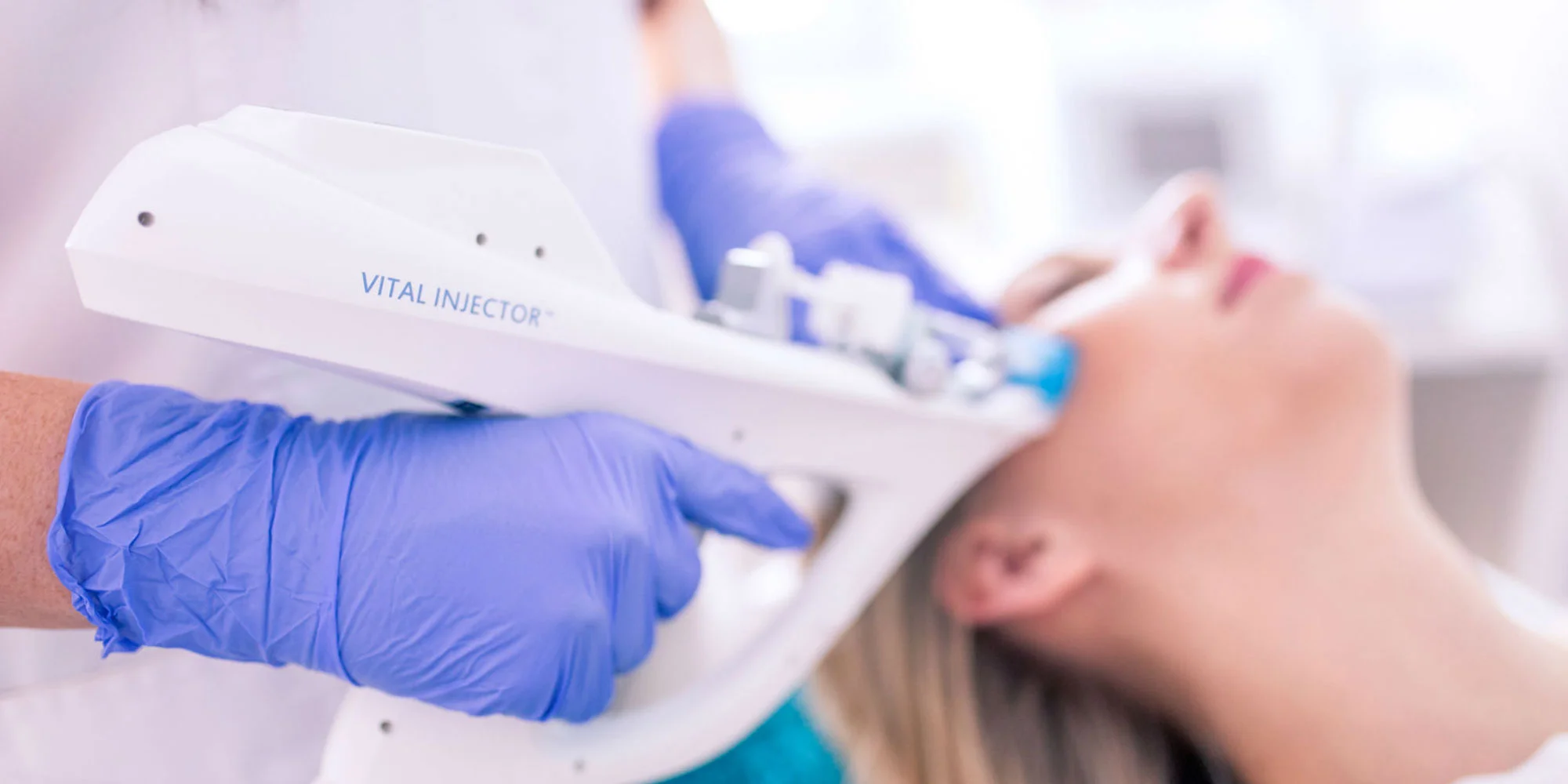 Mezoterapia kyselinou hyalurónovou pomocou Vital Injectora – Obrázok 3