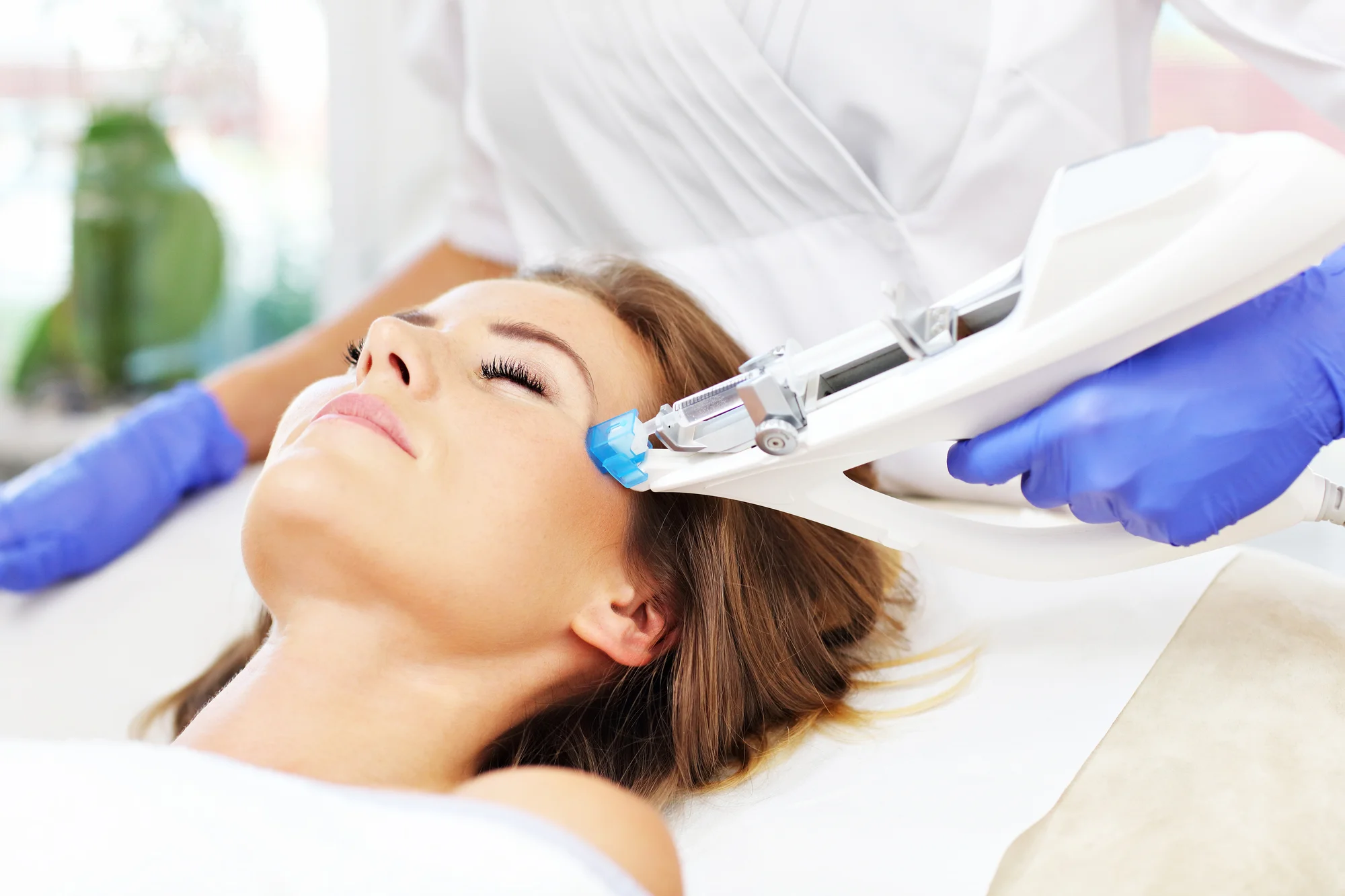 Skinbooster vital injector: omladenie pomocou lososej DNA – Obrázok 4