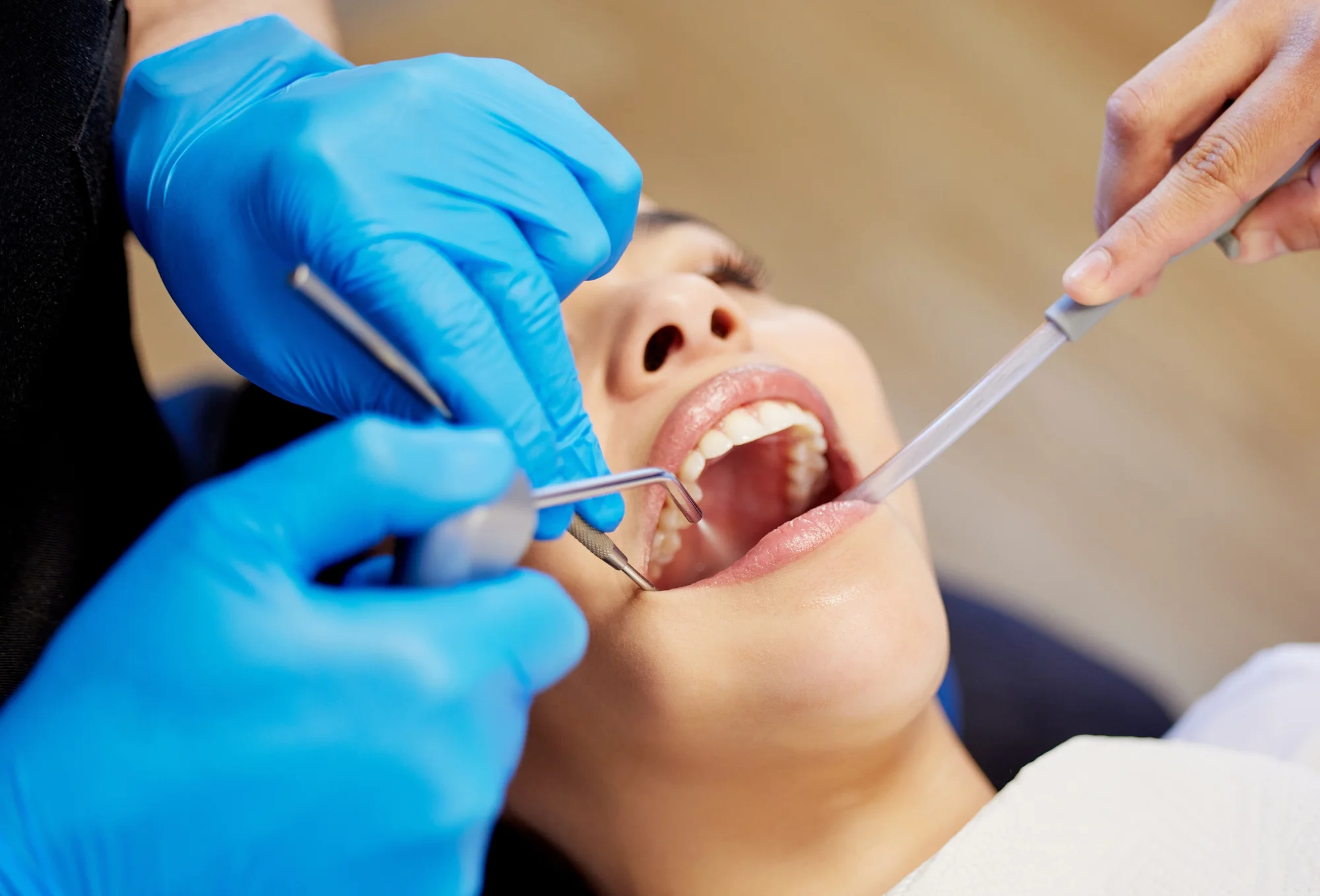 Profesionálna starostlivosť o váš úsmev: Dentálna hygiena alebo bielenie zubov – Obrázok 5