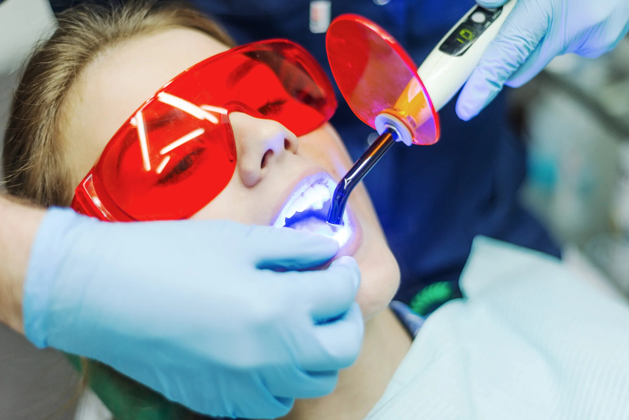 Profesionálna starostlivosť o váš úsmev: Dentálna hygiena alebo bielenie zubov – Obrázok 4