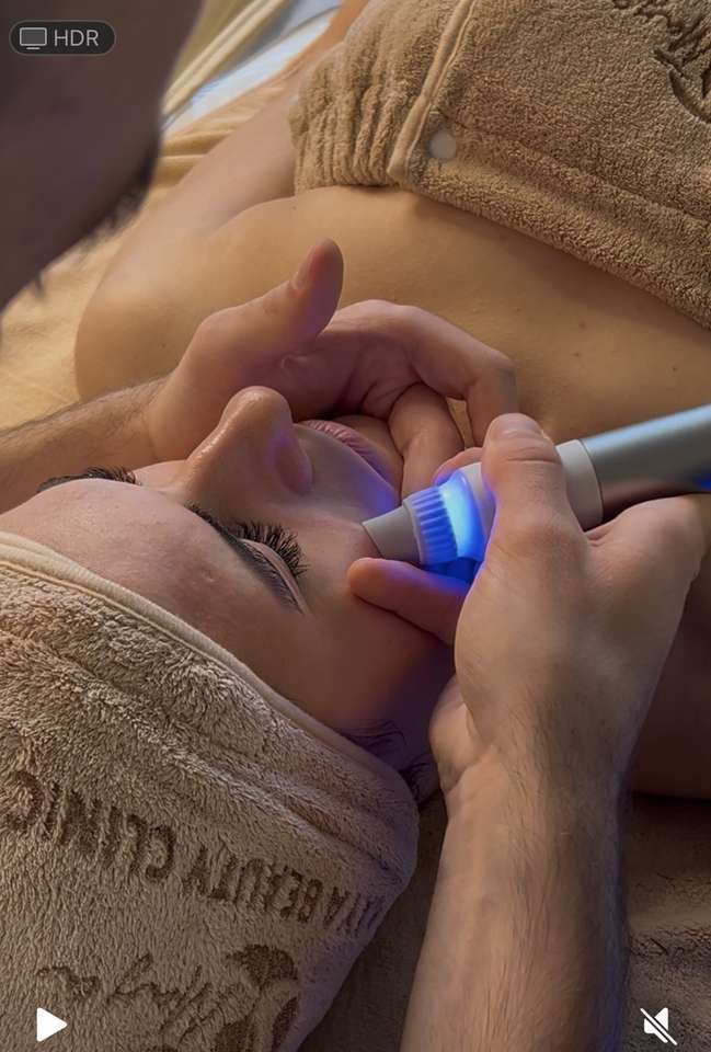 Ošetrenie Hydrafacial pre žiarivú pleť v Maya Beauty Clinic – Obrázok 2