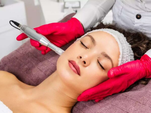 Omladzujúca mezoterapia – microneedling s chemickým peelingom + navyše úprava a farbenie obočia