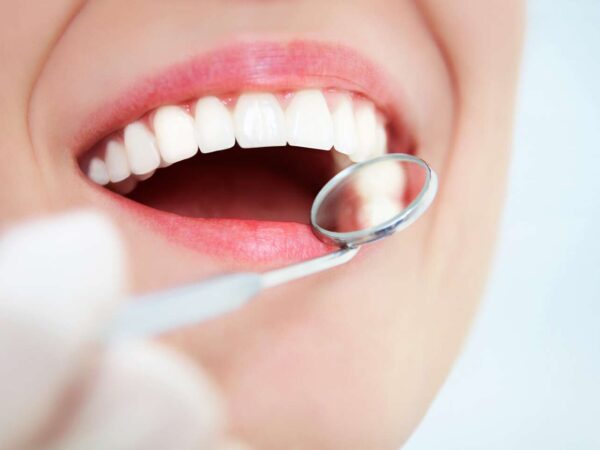 Dve dentálne hygieny v ročnom programe stomatologickej starostlivosti