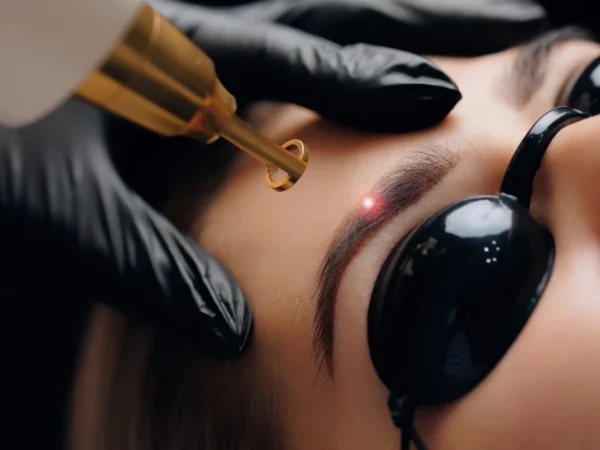 Laserové odstránenie tetovania alebo permanentného makeupu