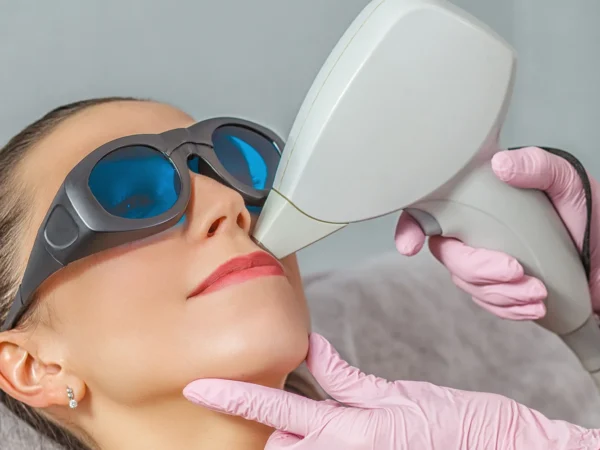 Laserová epilácia pre dámy: Horná pera, brada, podpazušie či bikiny