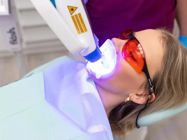 Profesionálne bielenie zubov Opalescence s dentálnou hygienou
