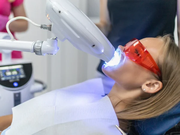 Dentálna hygiena a profesionálne bielenie zubov Perfect bleach