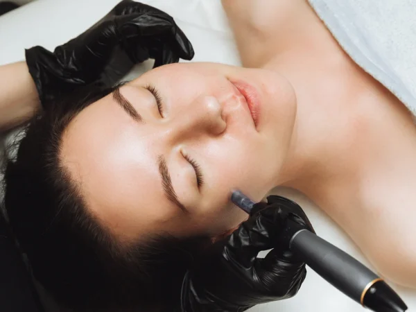Kozmetické ošetrenia: dermaplaning pre hladkú a sviežu pleť a mezoterapia