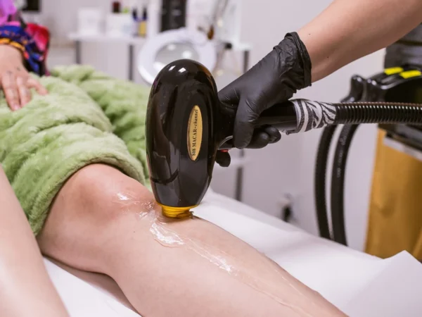 Odstránenie ochlpenia pomocou vysoko výkonného diódového lasera