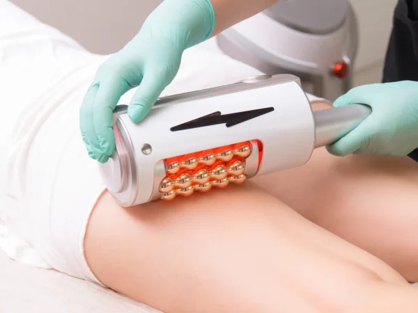 Endosférická masáž: Vaša cesta ku krásnemu telu a relaxu!
