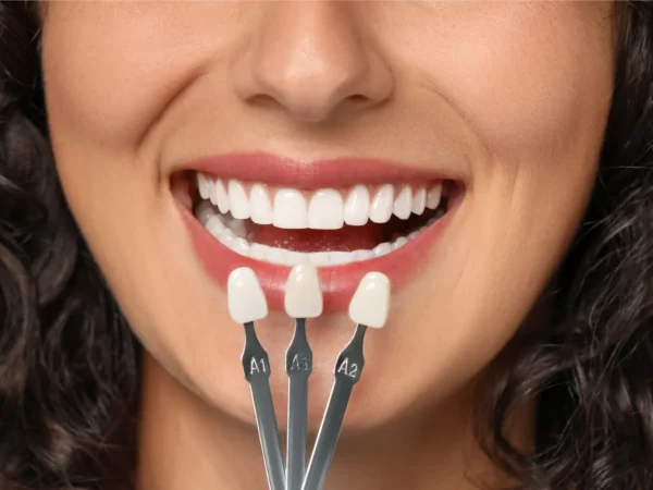 Linea Dent Poprad: Dentálna hygiena – samostatne aj v kombinácii s bielením zubov