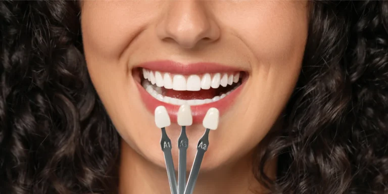 Linea Dent Poprad: Dentálna hygiena – samostatne aj v kombinácii s bielením zubov