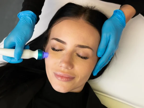 Hydrafacial: Unikátne rejuvenizačné ošetrenie pleti