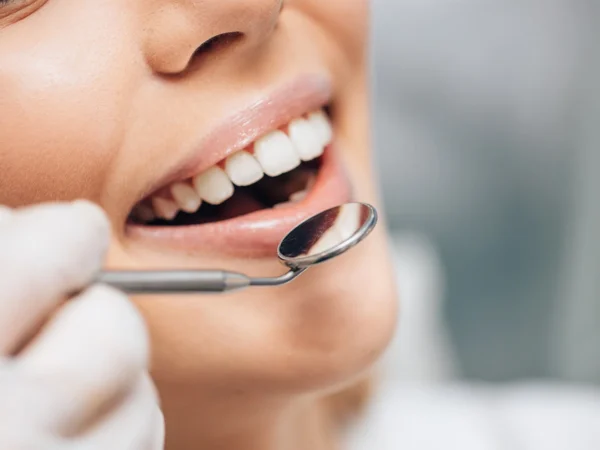 Profesionálna dentálna hygiena s pieskovaním pre deti i dospelých