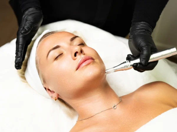 Účinné ošetrenia pre žiarivú pleť: Lososie spermie, karbónový laser aj microneedling