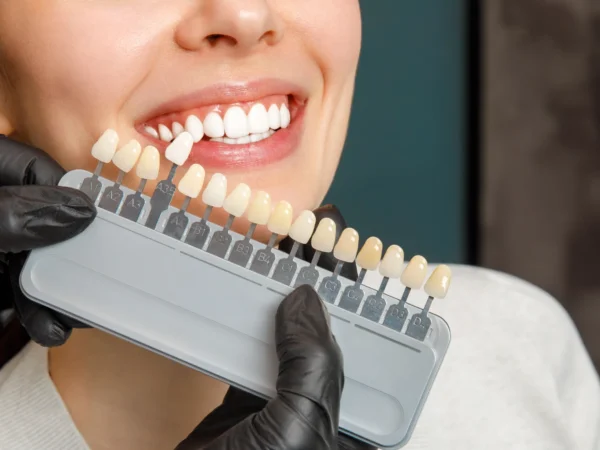 Dentálna hygiena, bielenie zubov aj otvorený voucher